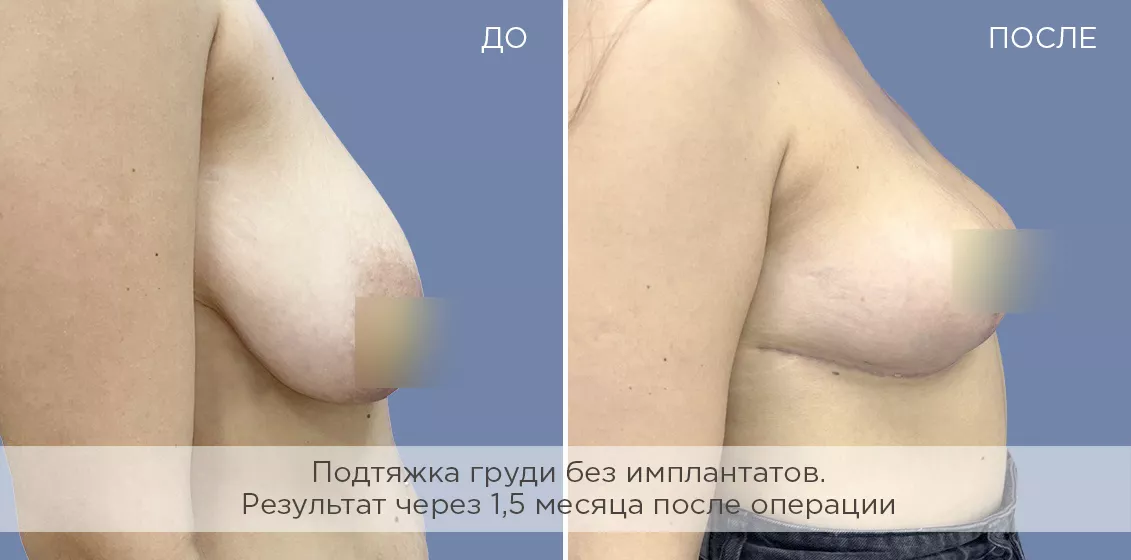Фотогалерия