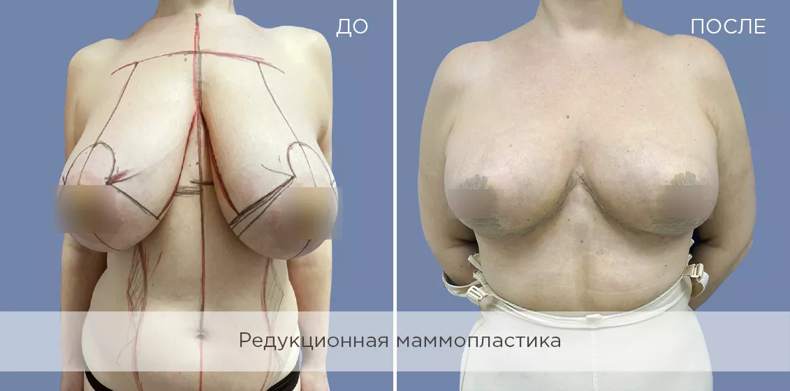 Фотогалерия