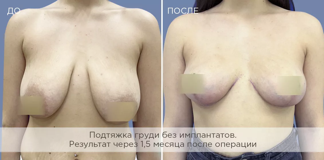 Фотогалерия