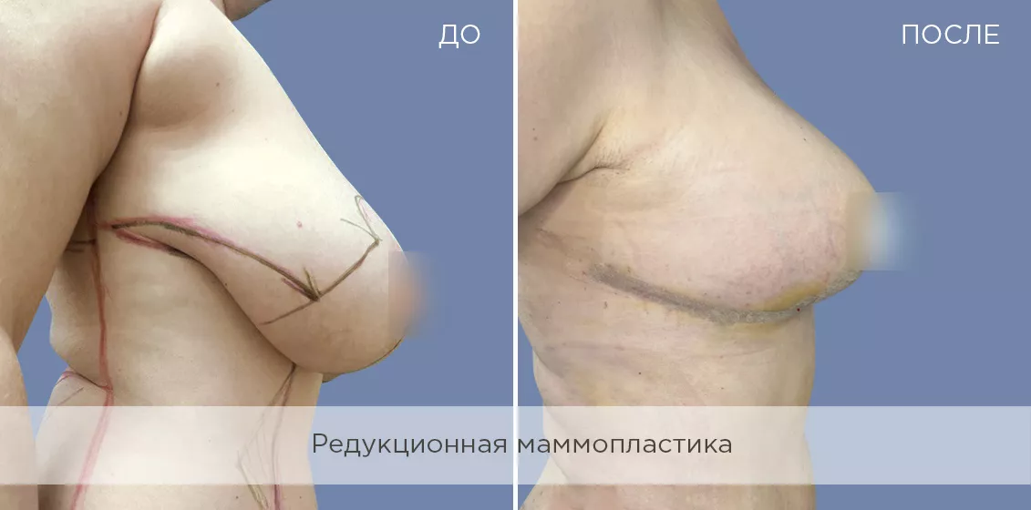 Фотогалерия