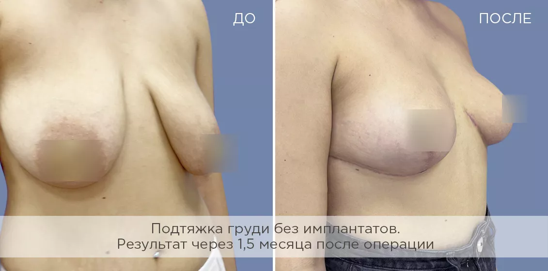 Фотогалерия